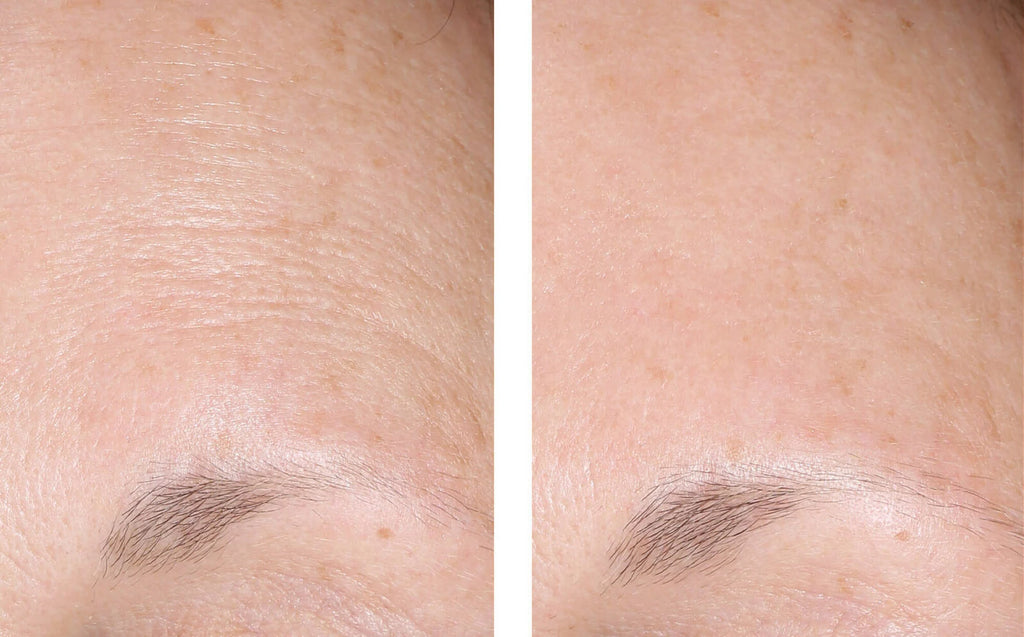 SkinBetter AlphaRet Overnight Cream