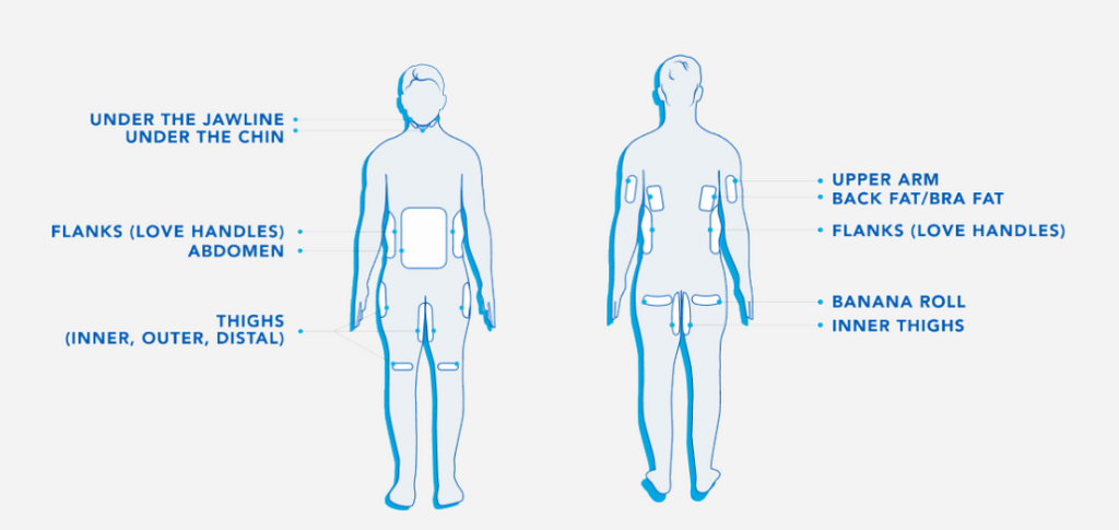 Coolsculpting Treatment