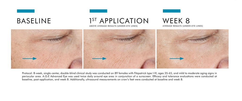 8-week results of using SkinCeuticals A.G.E. Advanced Eye showing reduced wrinkles, puffiness, and dark circles