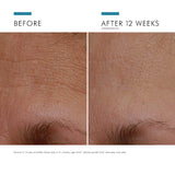 Before and after results of using SkinCeuticals A.G.E. Interrupter Advanced showing reduced wrinkles and improved skin firmness