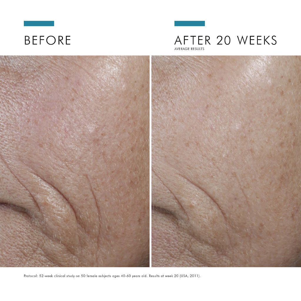 SkinCeuticals C E Ferulic before and after 20 weeks comparison showing improved skin tone, reduced fine lines, and enhanced radiance