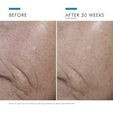 SkinCeuticals C E Ferulic before and after 20 weeks comparison showing improved skin tone, reduced fine lines, and enhanced radiance
