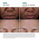 SkinCeuticals Cell Cycle Catalyst (30ml)