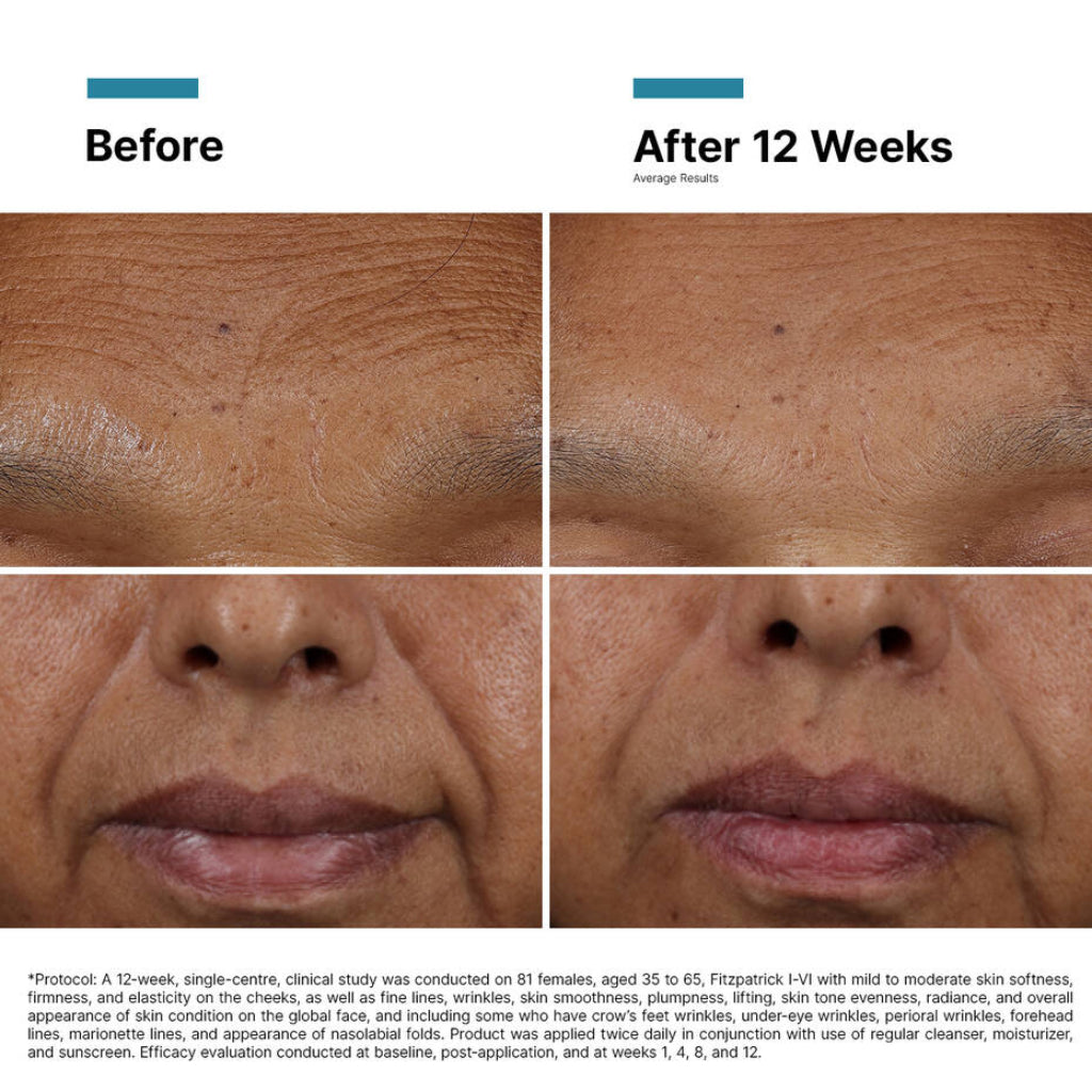 Before and after comparison of skin treated with SkinCeuticals H.A. Intensifier Multi-Glycan serum, showing visible improvement in skin plumpness, hydration, and fine line reduction