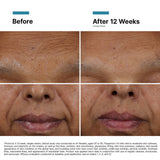 Before and after comparison of skin treated with SkinCeuticals H.A. Intensifier Multi-Glycan serum, showing visible improvement in skin plumpness, hydration, and fine line reduction