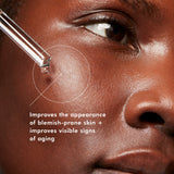 Swatch of SkinCeuticals LHA Serum applied on dark skin, showcasing its lightweight, clear texture and quick absorption for oily and acne-prone skin types.