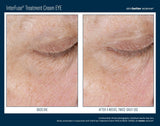 Skinbetter Instant Effect Gel EYE