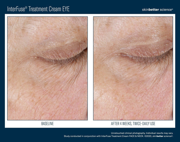 instant-effect-gel-eye-