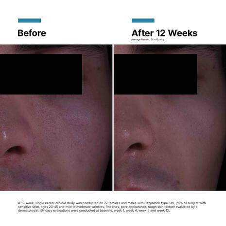 Skinceuticals P-TIOX Cream (48ml)