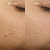 ZO Complexion Clarifying Serum (50ml)