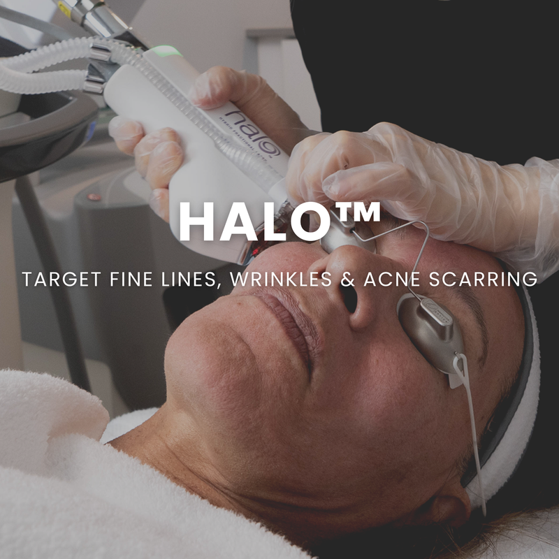 Halo Treatment