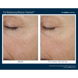 SkinBetter Trio Rebalancing Moisture Treatment™ (50ml)