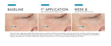 8-week results of using SkinCeuticals A.G.E. Advanced Eye showing reduced wrinkles, puffiness, and dark circles