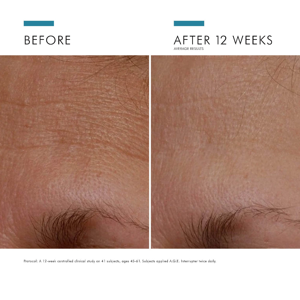 Before and after results of using SkinCeuticals A.G.E. Interrupter Advanced showing reduced wrinkles and improved skin firmness