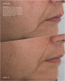 Before and after comparison of a person's face with text on skin texture changes.