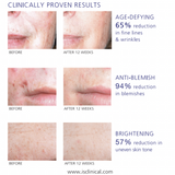Before and after skin treatment results of using iS Clinical Active Serum for 12 weeks with clinical proof on a white background