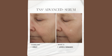 Before and after comparison of SkinMedica TNS Advanced+ Serum results, showing visible skin improvements, reduced wrinkles, and enhanced radiance after 2 weeks